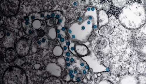 Coronavirus